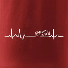 SDH EKG