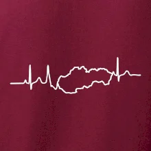 EKG Slovensko