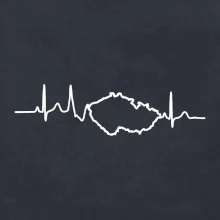 EKG Česká republika