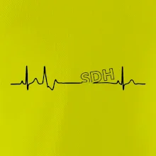 SDH EKG