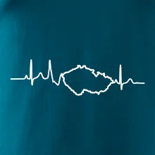 EKG Česká republika