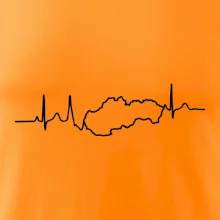 EKG Slovensko
