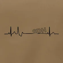 SDH EKG