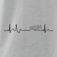 SDH EKG SDH EKG