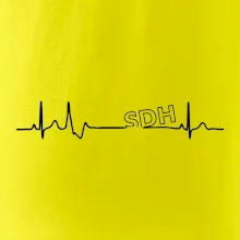 SDH EKG