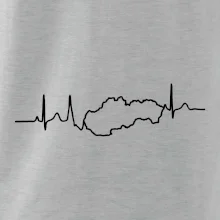 EKG Slovensko
