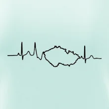 EKG Česká republika