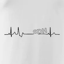 SDH EKG SDH EKG