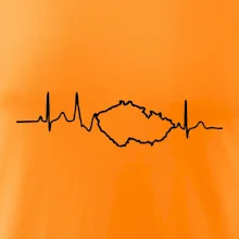 EKG Česká republika