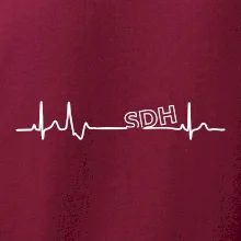 SDH EKG