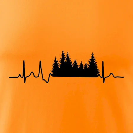 EKG les