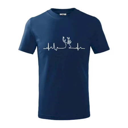 Jelen EKG