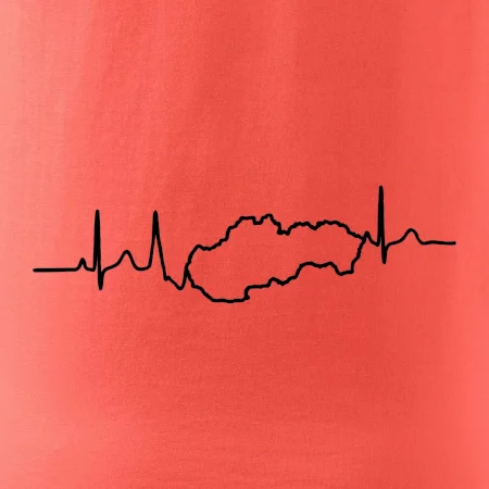 EKG Slovensko