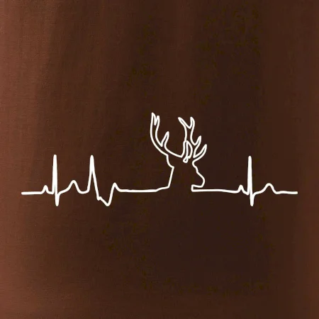 Jelen EKG