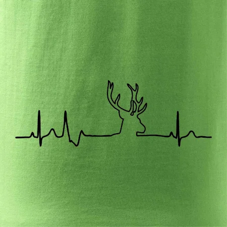 Jelen EKG