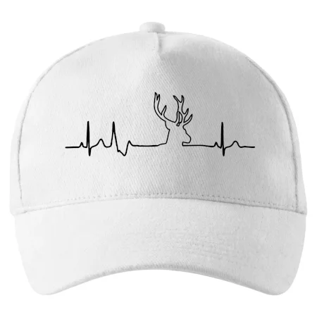 Jelen EKG
