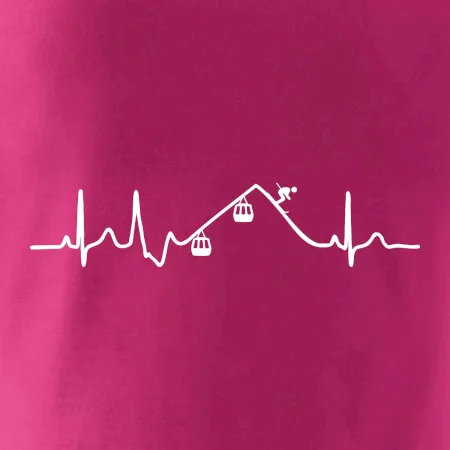 EKG lanovka