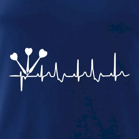 EKG šipky