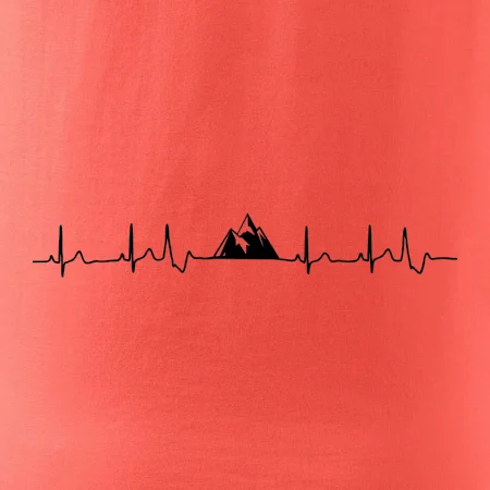 Hory EKG