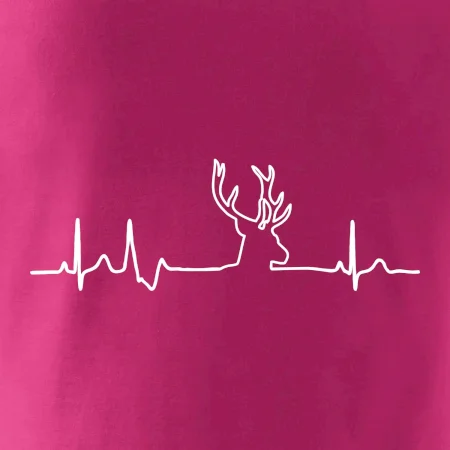 Jelen EKG