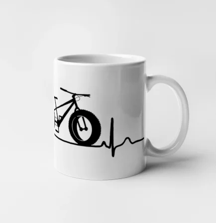EKG fatbike