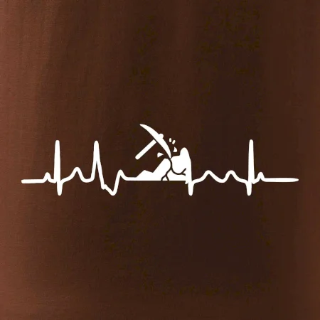 Ekg horník
