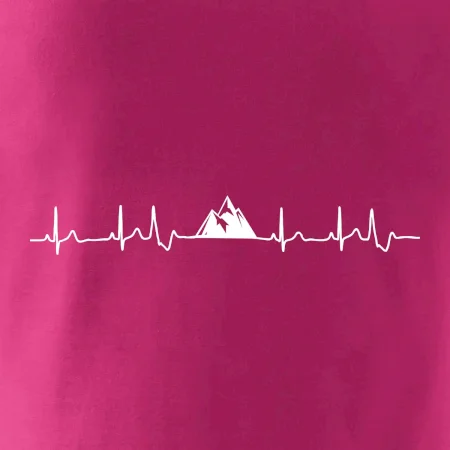 Hory EKG