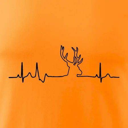 Jelen EKG