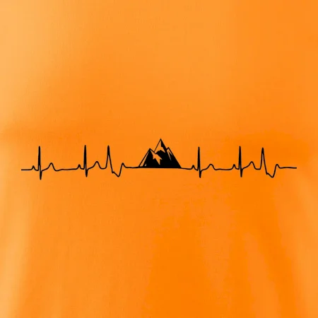 Hory EKG