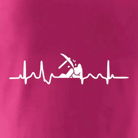 Ekg horník