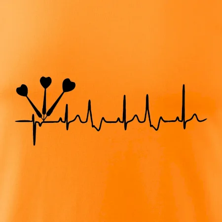 EKG šipky