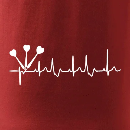 EKG šipky