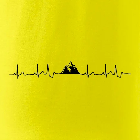 Hory EKG