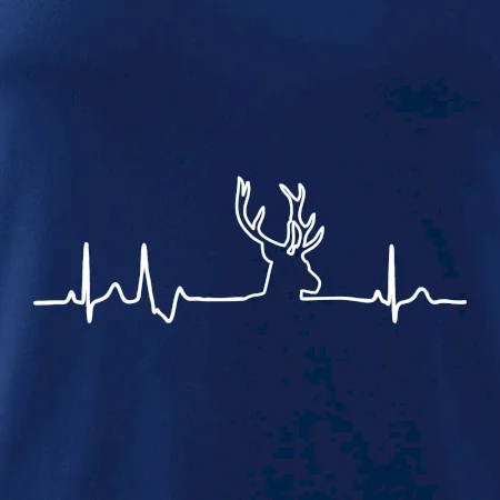 Jelen EKG