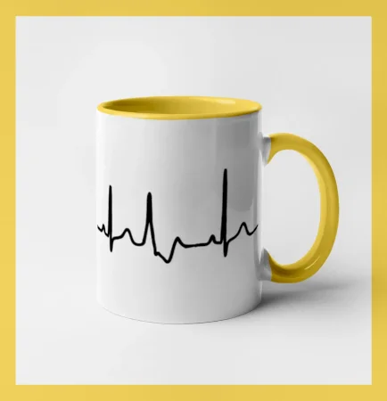 EKG šipky