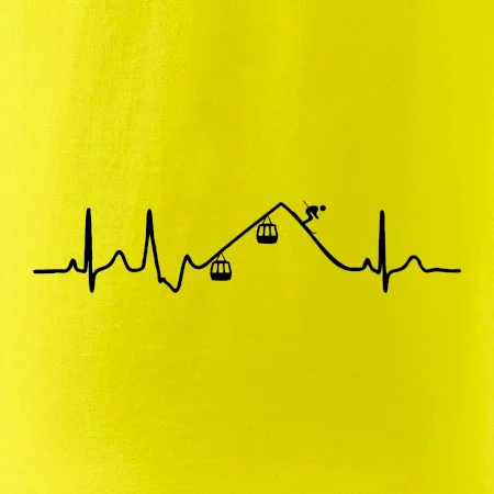 EKG lanovka