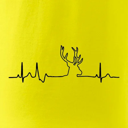 Jelen EKG