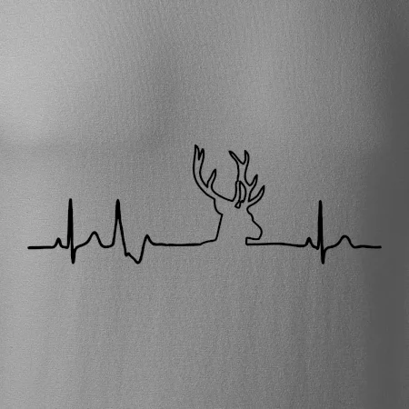 Jelen EKG