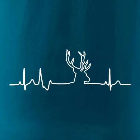 Jelen EKG