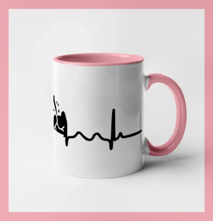 Ekg horník