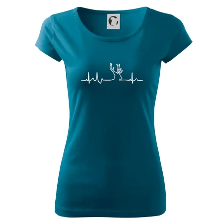 Jelen EKG