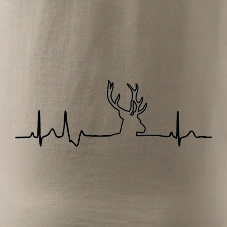 Jelen EKG
