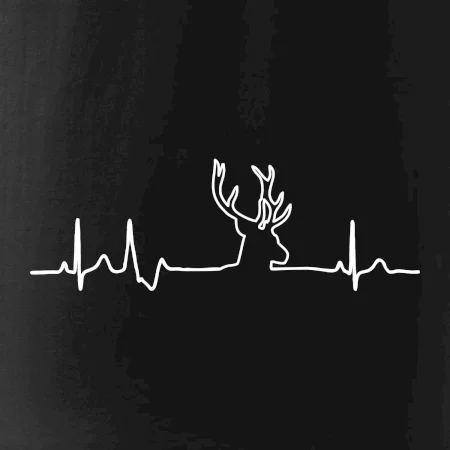 Jelen EKG