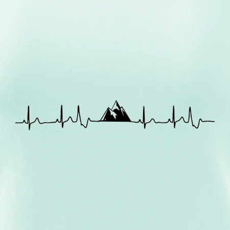Hory EKG
