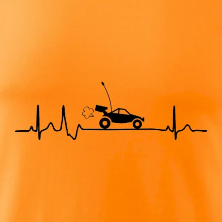 EKG RC model