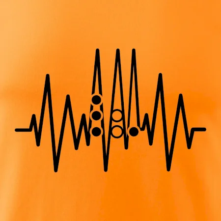 Backgammon  EKG