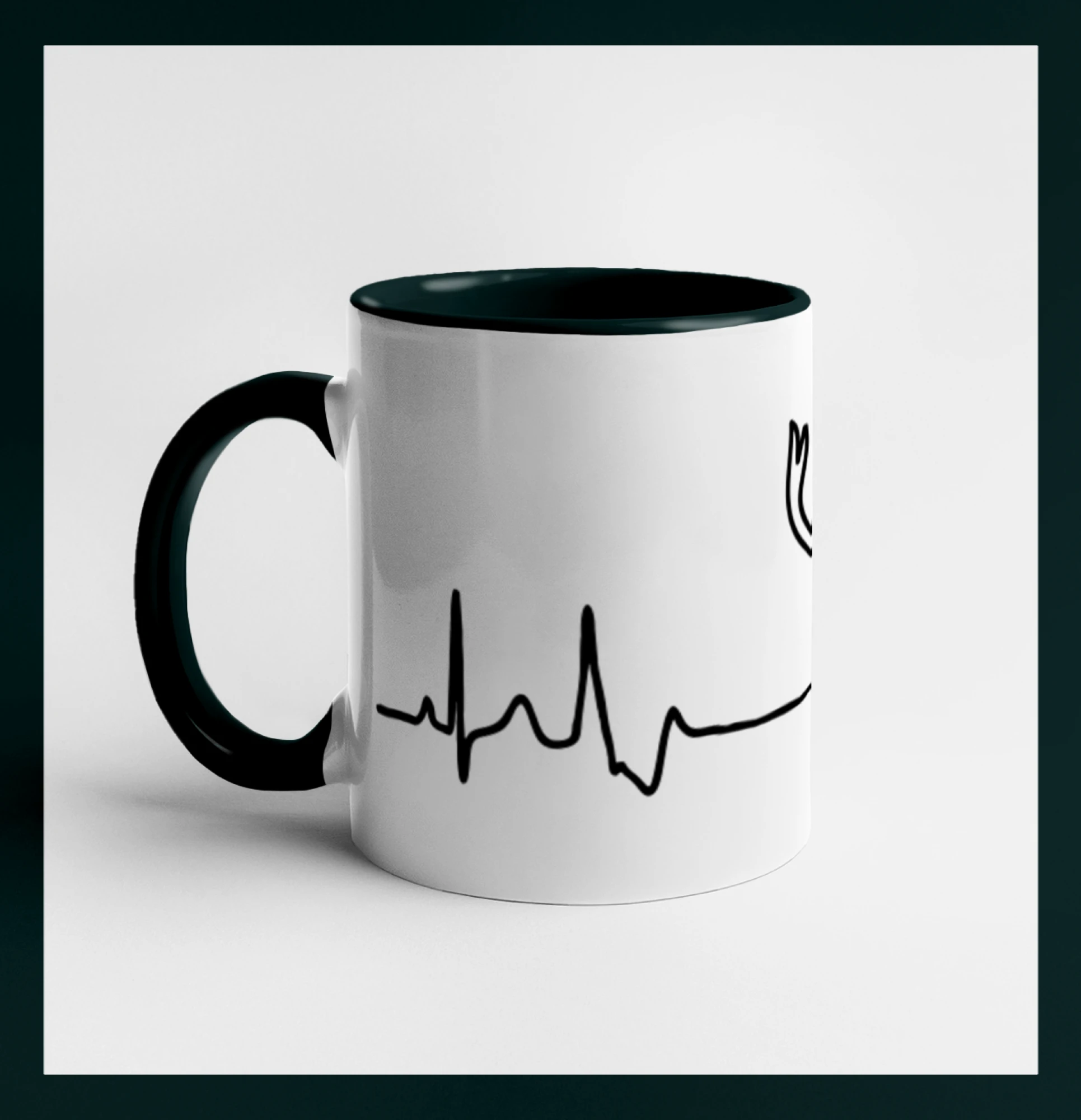 Jelen EKG