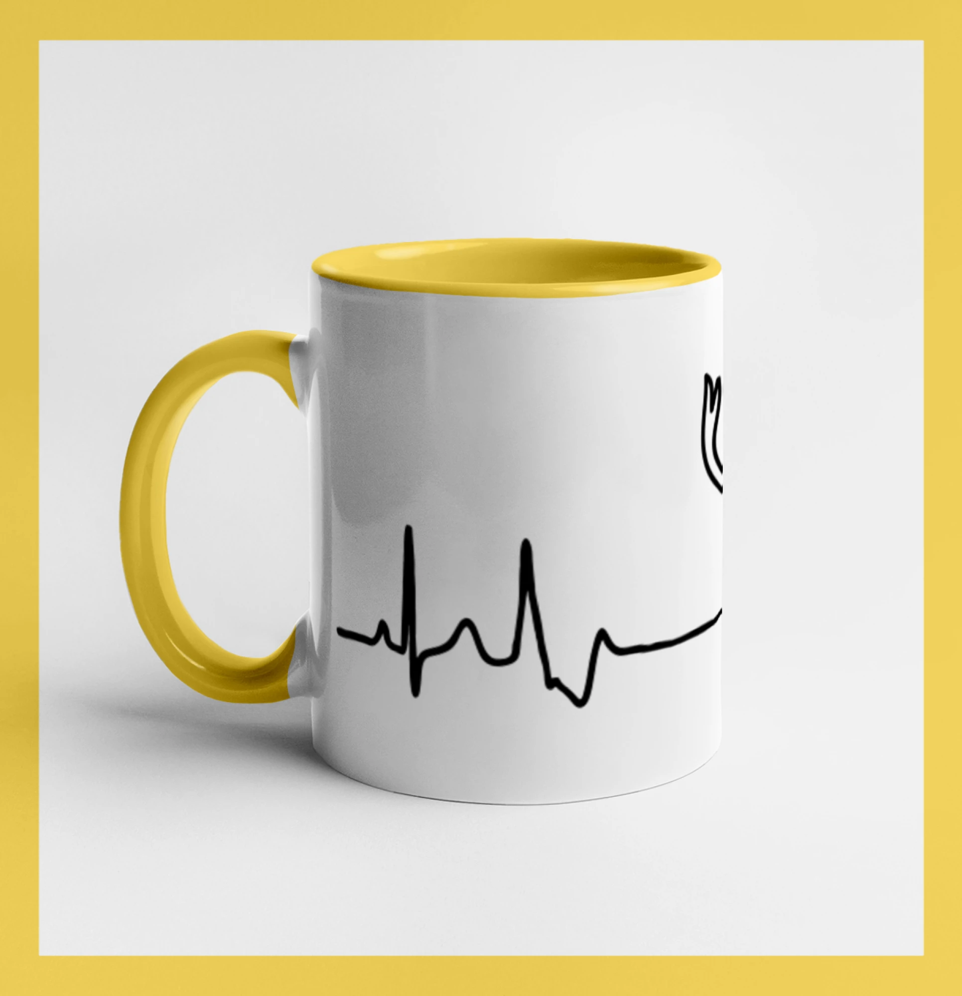 Jelen EKG