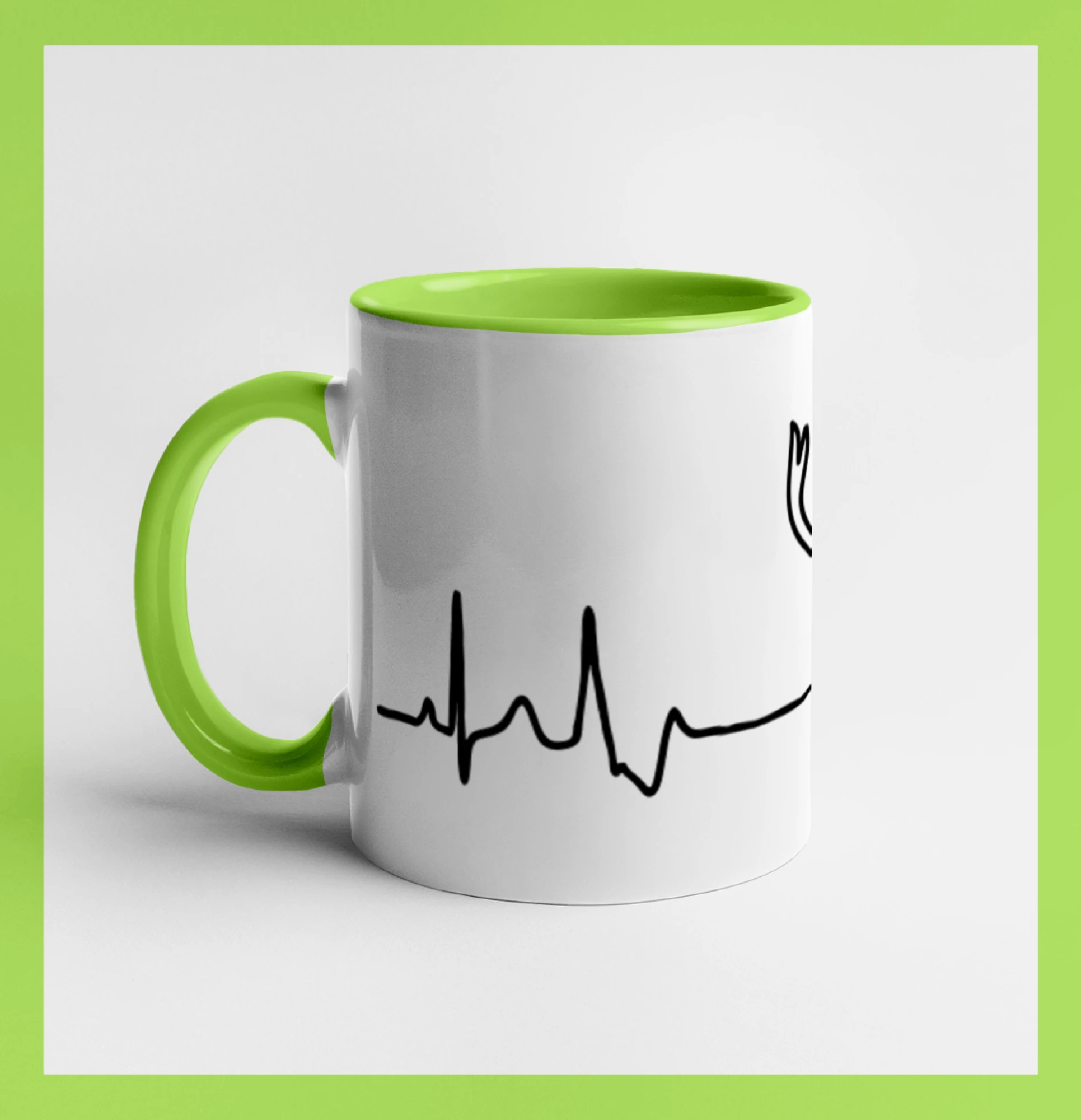Jelen EKG