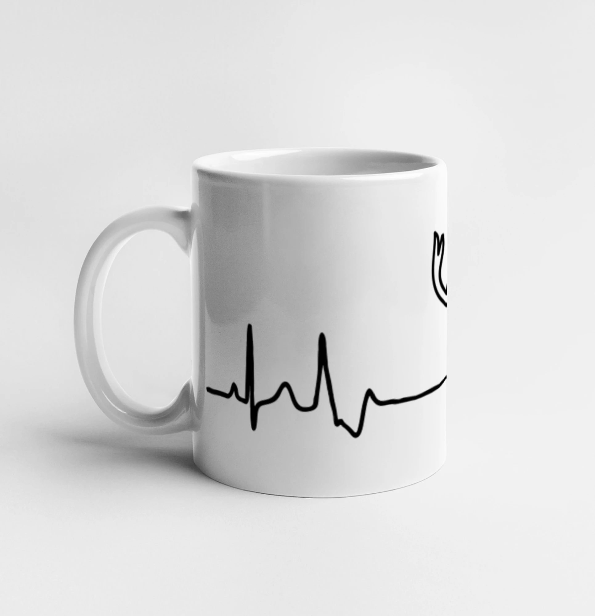 Jelen EKG